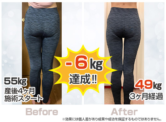 村井 ビフォーアフター