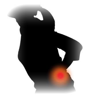 ぎっくり腰が悪くなるとどうなるの？